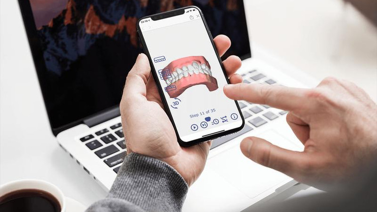 【業務委託】YouTubeチャンネル等SNSの企画・制作・運用担当募集！＜株式会社Oh my teeth＞